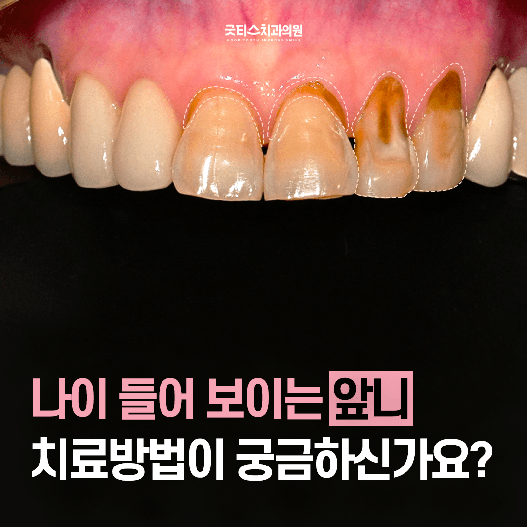 메인 이미지 3