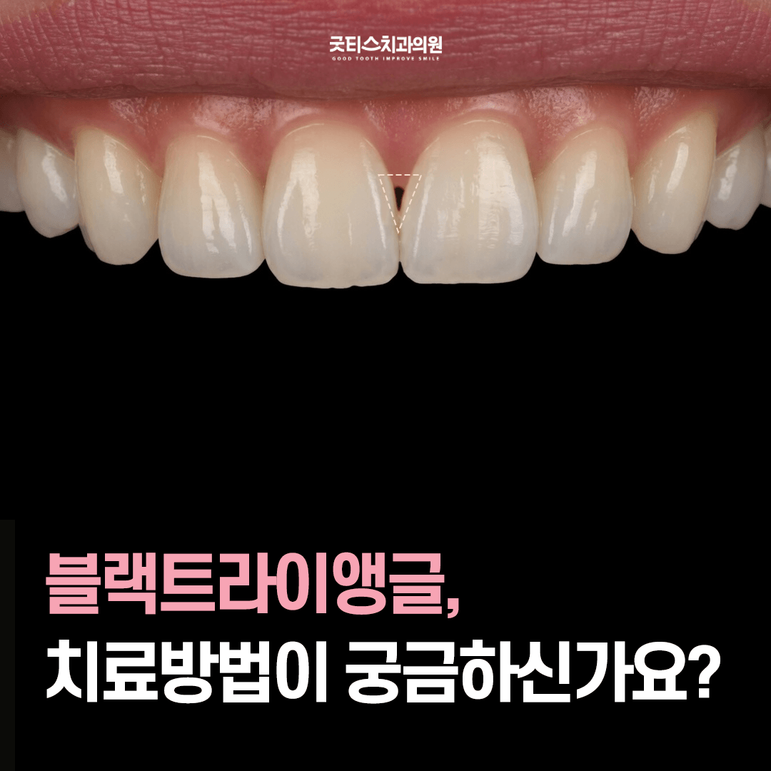 메인 이미지 4